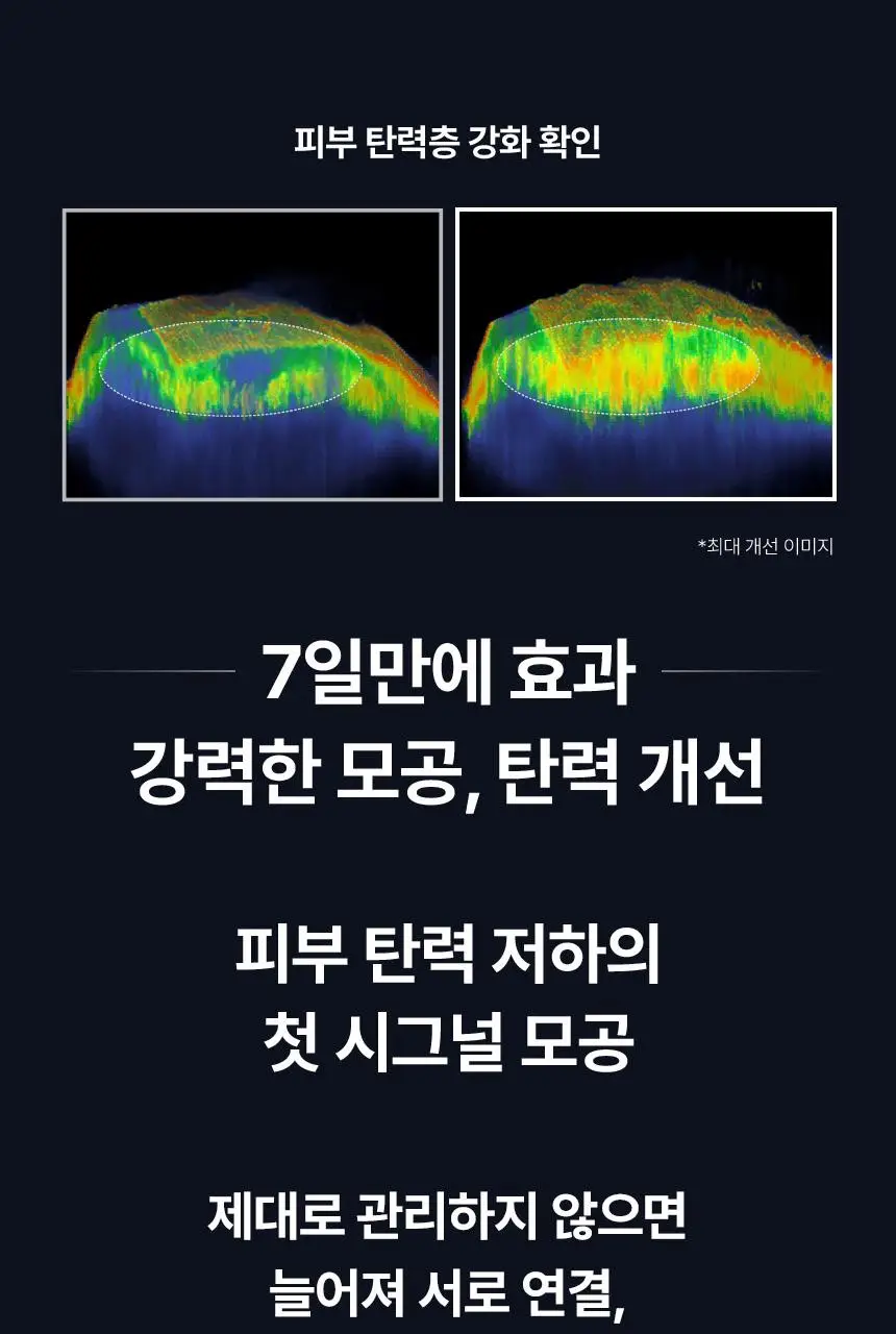 [자극도ZERO]아이오페 레티놀 슈퍼 바운스 세럼 20ml 기획 (+15ml) 상세페이지 15